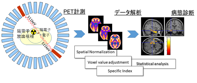 PET計測によるデータ解析、病態診断